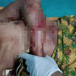 Diterkam Buaya Saat Mandi di Sungai, Pria Asal Muna Barat Dilarikan ke Rumah Sakit